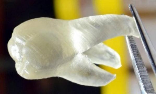 新型牙科树脂聚合物3D打印假牙（附图）