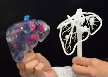 3D打印给医疗行业带来深远影响